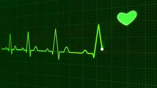 EKG